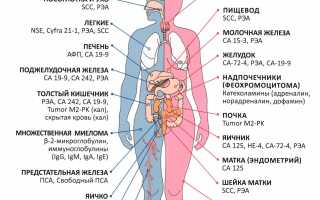 Онкомаркеры на рак горла и гортани — SCC и cyfra 21-1, что показывают, расшифровка показателей
