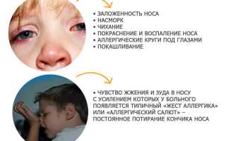 Аллергический отек носа