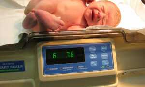 Потеря веса у новорожденных в первые дни