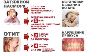 Особенности лечения аденоидита у детей в зависимости от проявлений болезни