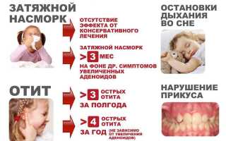 Особенности лечения аденоидита у детей в зависимости от проявлений болезни