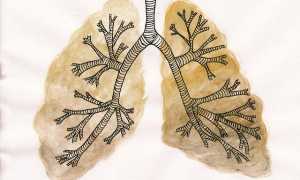 Чем лечить бронхит у беременных
