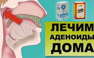 Лечение аденоидов народными средствами и в домашних условиях