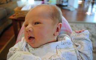 Кефалогематома у новорожденного