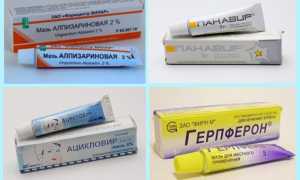 Мазь от герпеса в интимной зоне
