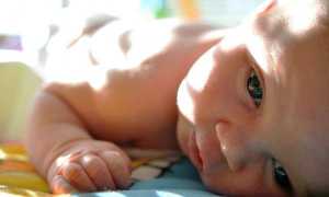 Неровная голова у грудничка