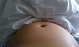 КТГ при беременности: необходимо или нет?