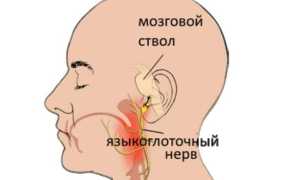 Что делать если болит ухо при глотании?