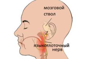 Что делать если болит ухо при глотании?
