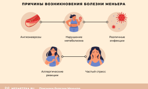 Болезнь Меньера (синдром Меньера)