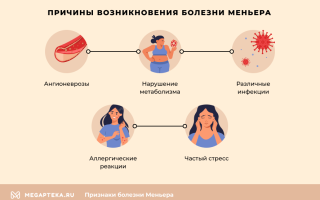 Болезнь Меньера (синдром Меньера)