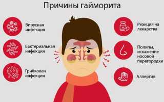 Грибковый гайморит: причины, клиническая картина и методы лечения