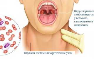 Вирус Эпштейна-Барра
