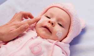 Что нужно делать, если у грудничка очень сухая кожа