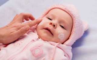 Что нужно делать, если у грудничка очень сухая кожа