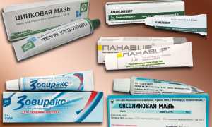 Мази при лечении герпеса