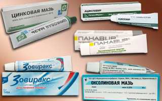 Мази при лечении герпеса
