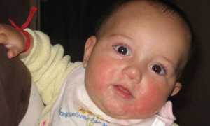 Супрастин для грудничка