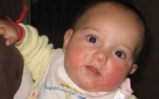 Супрастин для грудничка