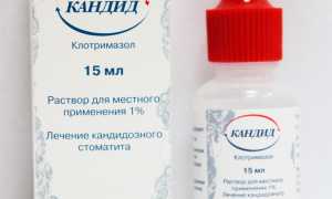 Кандид против стоматита
