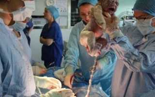 Давление после родов: что делать?