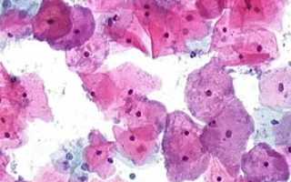 Gardnerella vaginalis: что это, причины и пути передачи