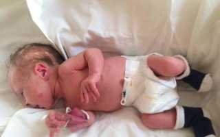 Порок сердца у новорожденных: изучаем этапы развития врожденного дефекта и способы его лечения