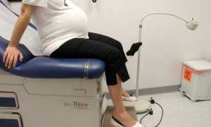 На каком сроке ребенок переворачивается вниз головой и занимает правильное тазовое предлежание