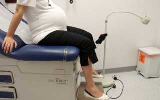 На каком сроке ребенок переворачивается вниз головой и занимает правильное тазовое предлежание