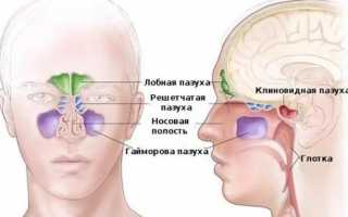 Пансинусит у взрослых и детей