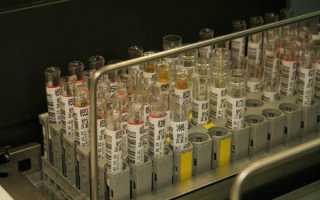 Глюкоза в моче при беременности: причины и последствия, нормы, отзывы