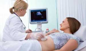 Готовимся к первой встрече с малышом или зачем нужно узи