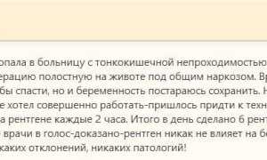 Можно ли делать рентген при беременности на ранних и поздних сроках