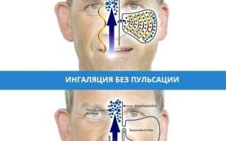 Ингаляции при синусите