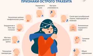 Заразен ли трахеит для окружающих и как он передается?