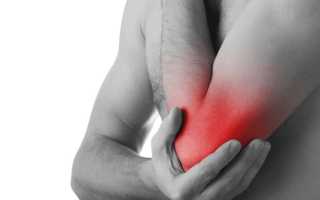 Опух локтевой сустав: почему и что делать?