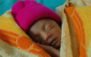 Водянка головного мозга у новорожденного