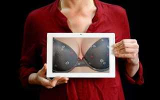 Лечение мастита у кормящей мамы