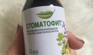 Стоматофит против стоматита