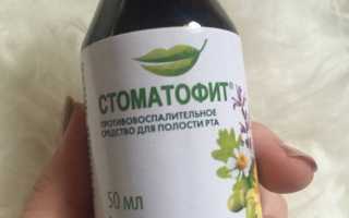 Стоматофит против стоматита