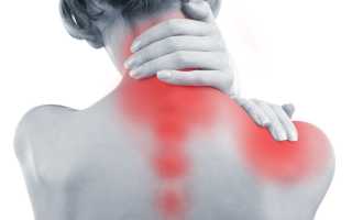 Причины возникновения и симптоматика вертеброгенной цервикалгии: формы и основные проявления