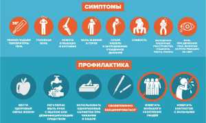 Грипп — причины, первые признаки и симптомы, лечение, осложнения вируса гриппа и профилактика