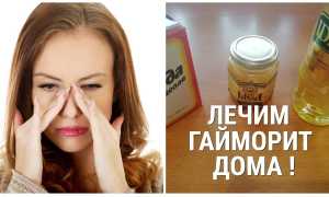 Лечение хронического гайморита народными средствами и в домашних условиях
