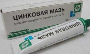 Как правильно выбрать средства для профилактики и лечения опрелостей у новорожденных