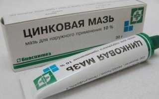 Как правильно выбрать средства для профилактики и лечения опрелостей у новорожденных