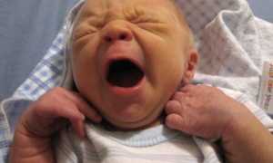 Симптом Грефе у грудничков: что это, Комаровский, лечение, отзывы (с форума)