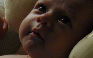 Чем лечить конъюнктивит у ребенка при разных формах воспаления: подбираем препараты и народные средства