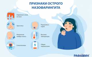 Что такое назофарингит, особенности развития, симптомы и лечение у детей и взрослых