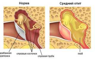 Как и чем устранить боль внутри уха?