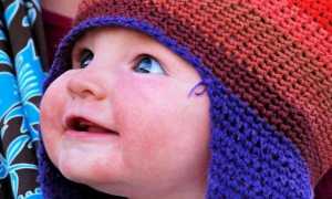 Почему у новорожденного красные щеки